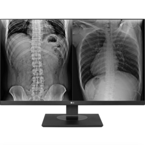 Monitor Diagnóstico 27 polegadas 8MP
