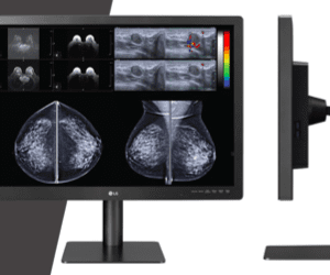 Monitor Diagnóstico para Mamografia 31 polegadas 12M