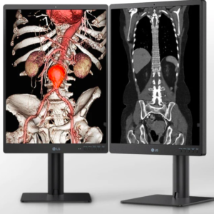 Monitor Diagnóstico 21,3 polegadas 3MP