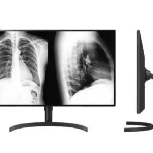 Monitor Diagnóstico 32 polegadas 8MP