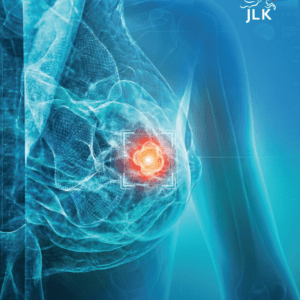 JLK AI MAMO - Inteligência Artificial para Mamografia.